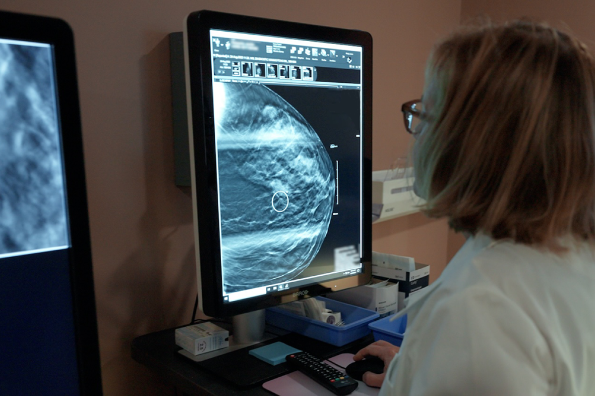 Dr. Ermelinda Bonaccio studies a mammogram image before performing a biopsy 