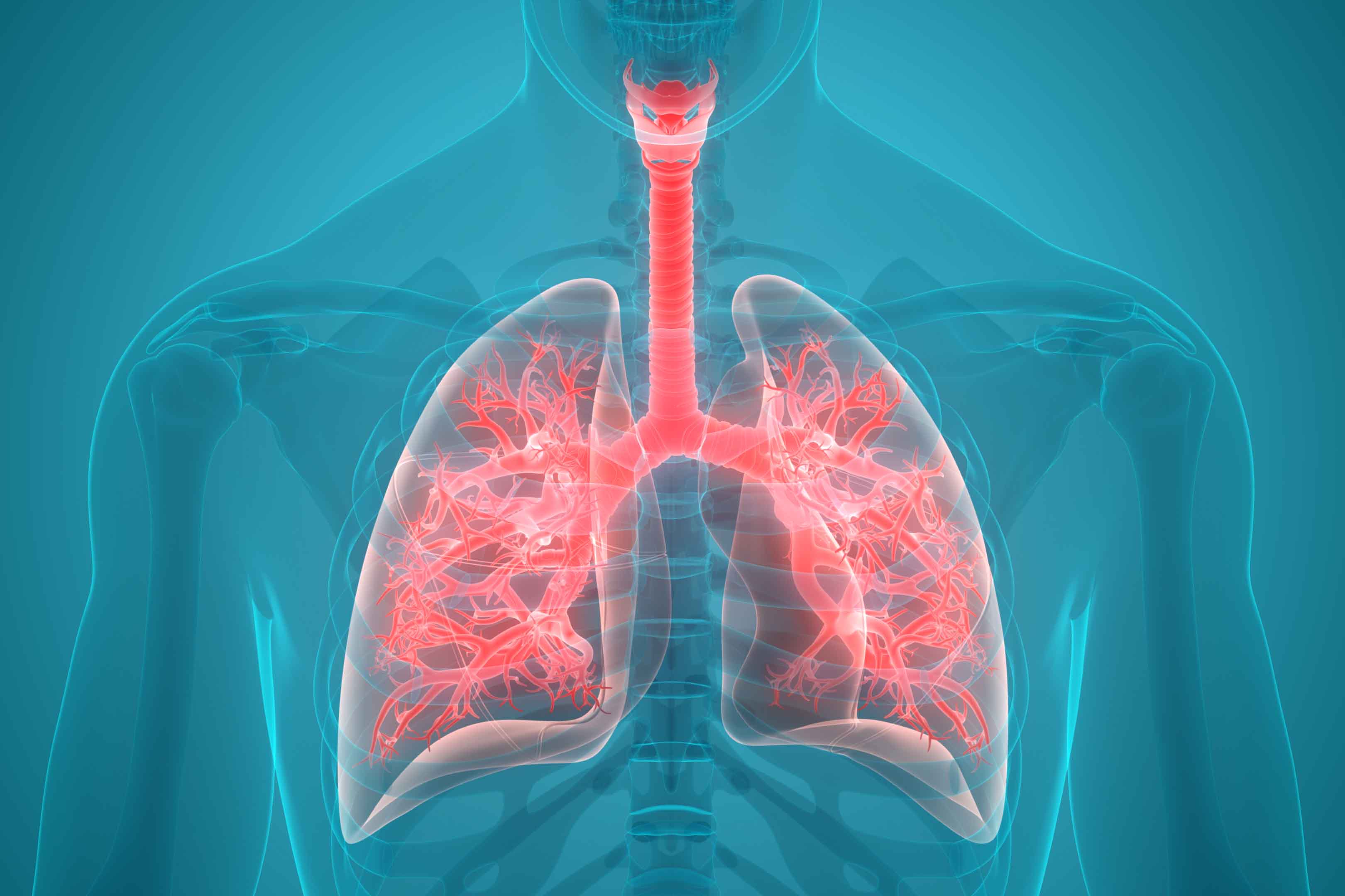 What Causes Lung Pain in the Back?  Roswell Park Comprehensive Cancer  Center - Buffalo, NY