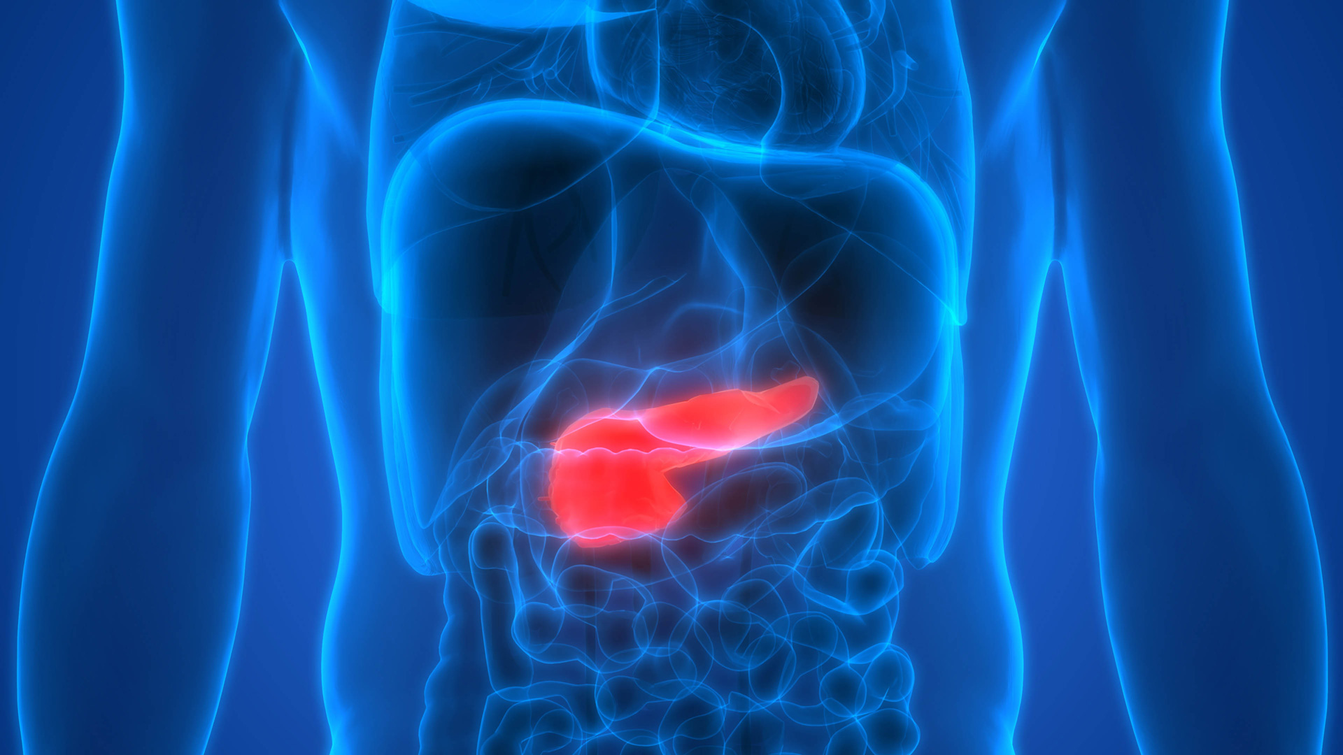Newswise: Roswell Park Study Defines Mechanisms Underlying Promising Precision Therapy for Pancreatic Cancer