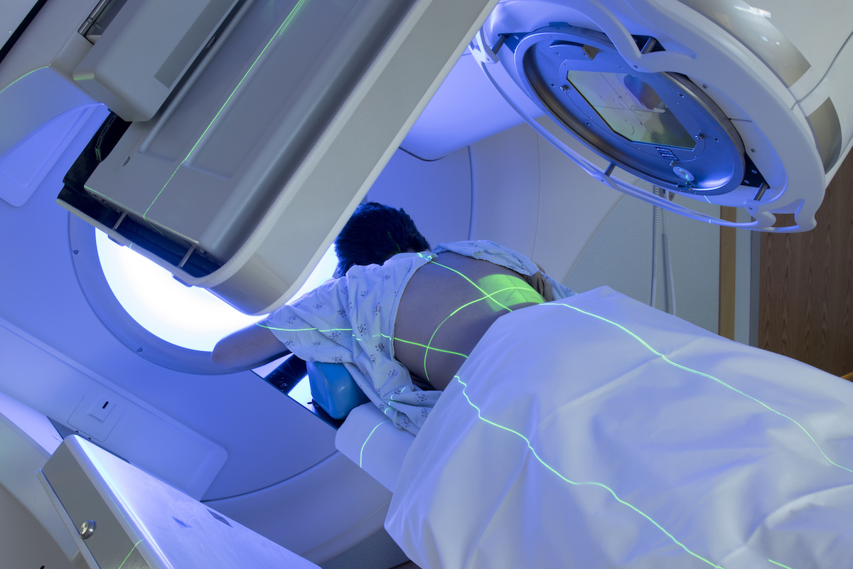 Skin care tips for radiation therapy patients  Roswell Park Comprehensive  Cancer Center - Buffalo, NY