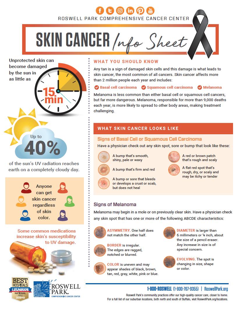 What Is Skin Cancer Roswell Park Comprehensive Cancer Center Buffalo Ny 0375