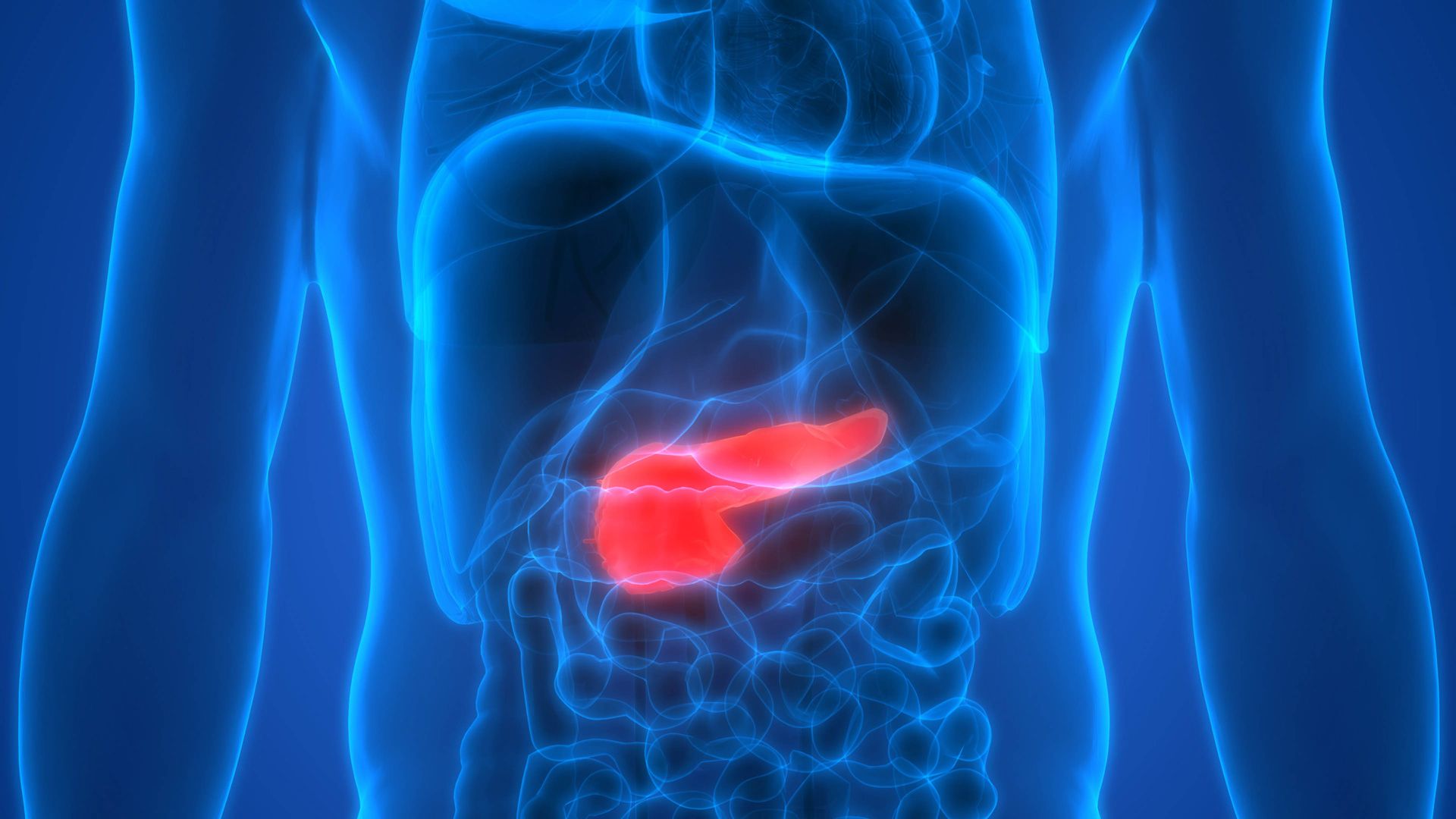 Symptoms of Pancreatic Cancer: The Importance of Early Detection ...