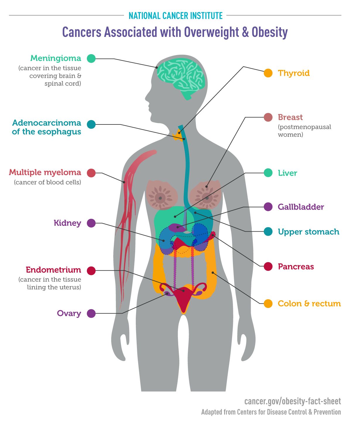 Cancer Crisis Overweight And Obesity On Track To Cause More Cancers Than